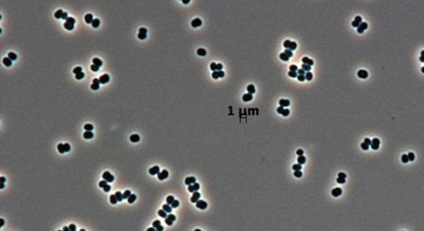 Tersicoccus phoenicis.