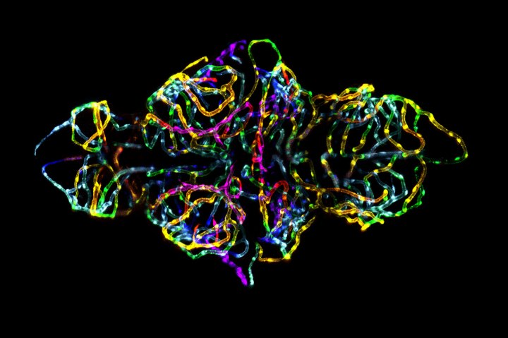 Brain of a live zebrafish embryo. 